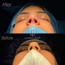 نمونه کارهای دکتر علی جمشیدی یکی از خوب ترین جراح زیبایی بندرعباس