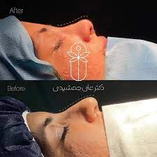 نمونه کارهای دکتر علی جمشیدی بهترین جراح پلاستیک بندرعباس