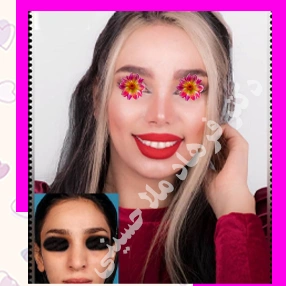 نمونه کارهای دکتر فرهاد ملاحسینی یکی از خوب ترین متخصص زیبایی صورت در بندرعباس