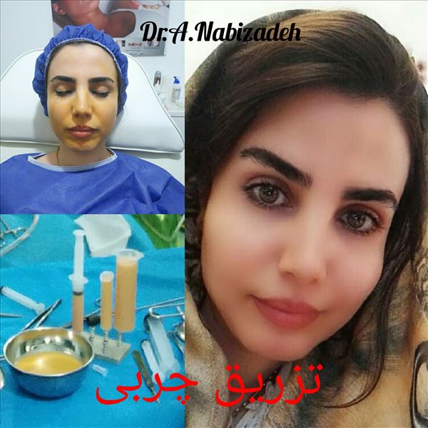 نمونه کارهای دکتر علیرضا نبی زاده  (6 تا از بهترین متخصص زیبایی بندرعباس|معرفی+نمونه کار+آدرس)