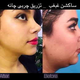 نمونه کارهای دکتر فردوس مذنبی (6 تا از بهترین متخصص زیبایی بندرعباس|معرفی+نمونه کار+آدرس)